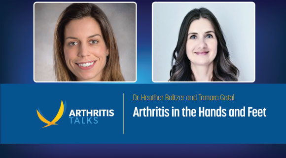 Arthritis in the Hands and Feet on Jan