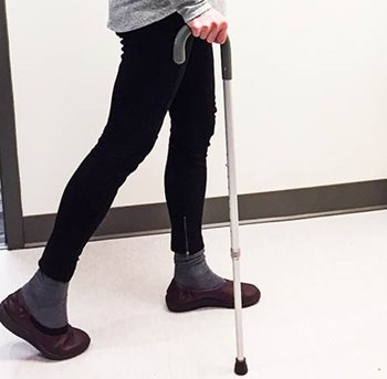 Photography of a someone using a cane