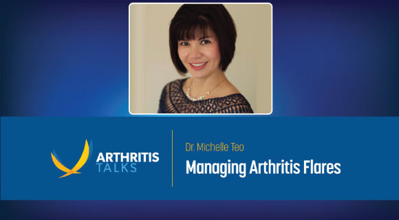 Managing Arthritis Flares on Sep