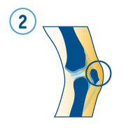 Icon of a knee with a circle around the area in pain