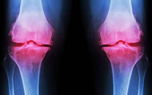 Can decreasing weight decrease pain?