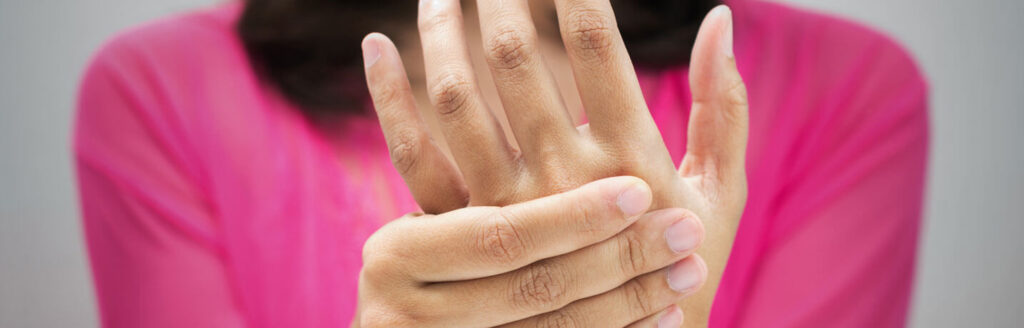 Mixed Connective Tissue Disease (MCTD)