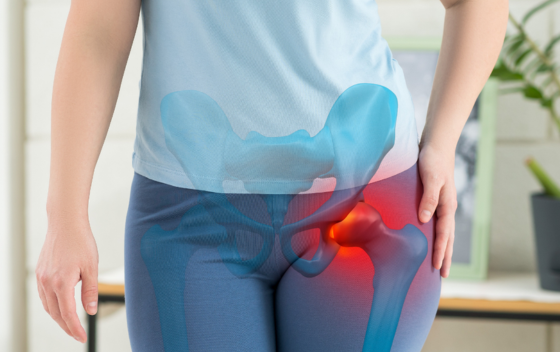 Hip surgery for arthritis: What you need to know